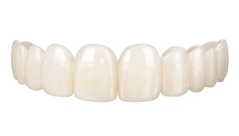 Peak Smile Snap-On Veneers - Custom Cosmetic Clip-On Veneers